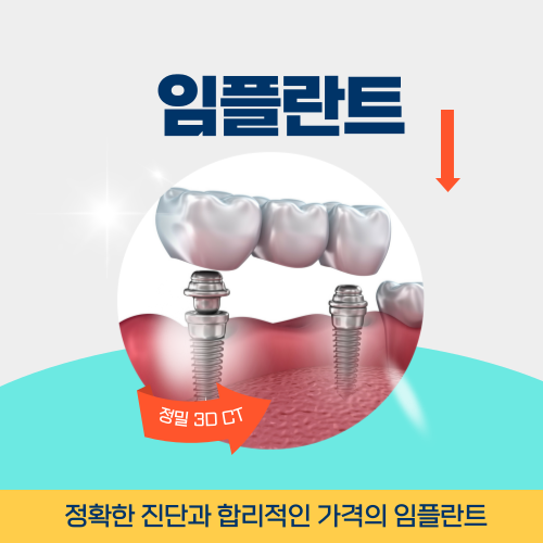 부천치과 임플란트
