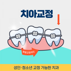부천치과 치아교정